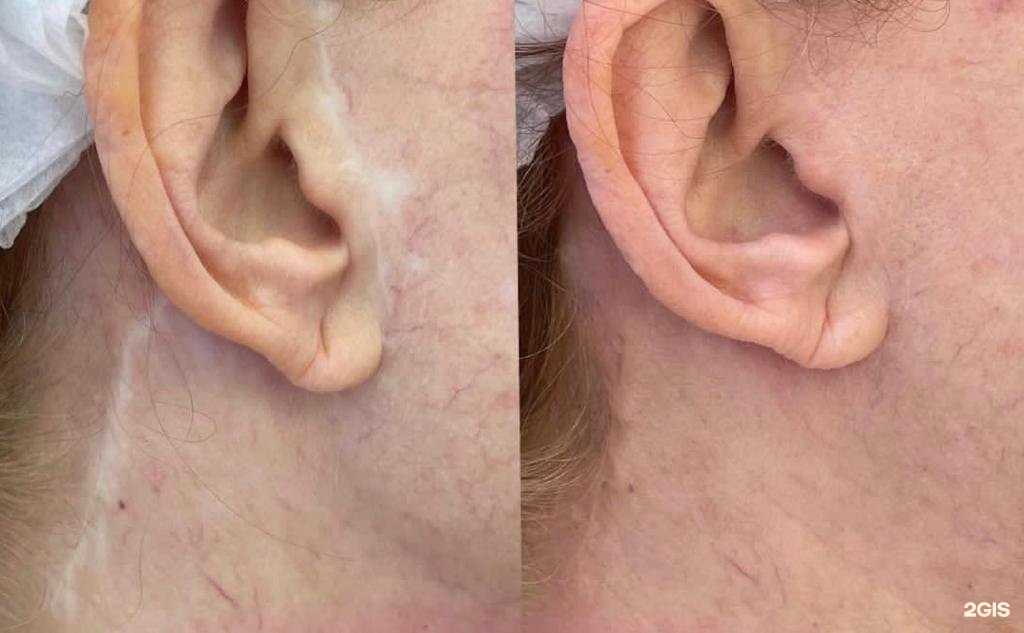 Отзывы на компанию Brovi_vkazani в г. Казань c фото