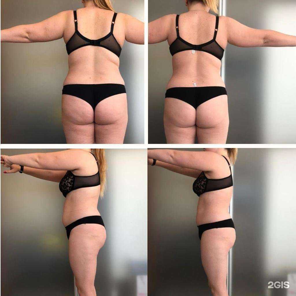 Отзывы на компанию Laser skin в Хабаровске c фото