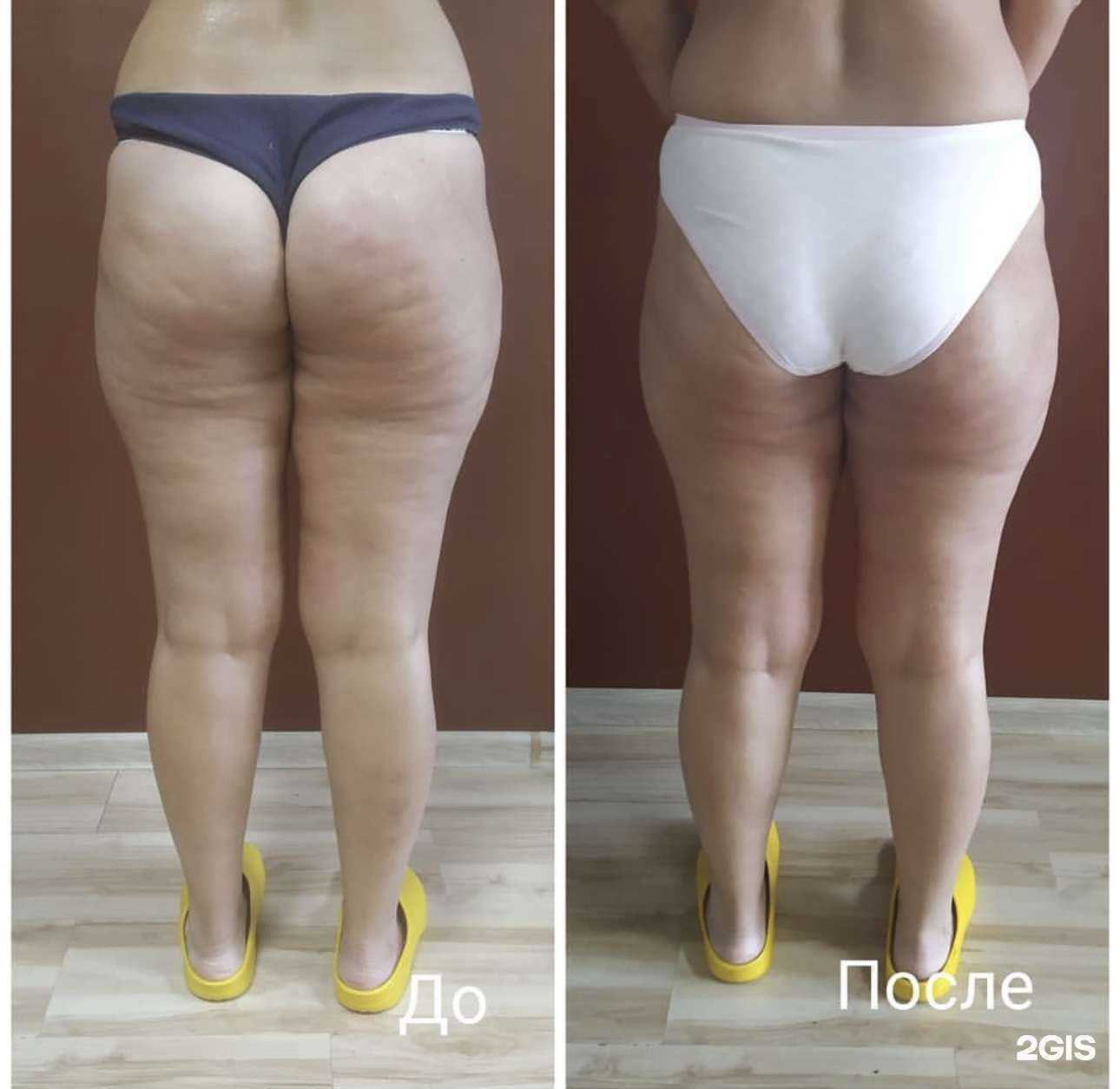 Отзывы на компанию Starvac в Уссурийске c фото