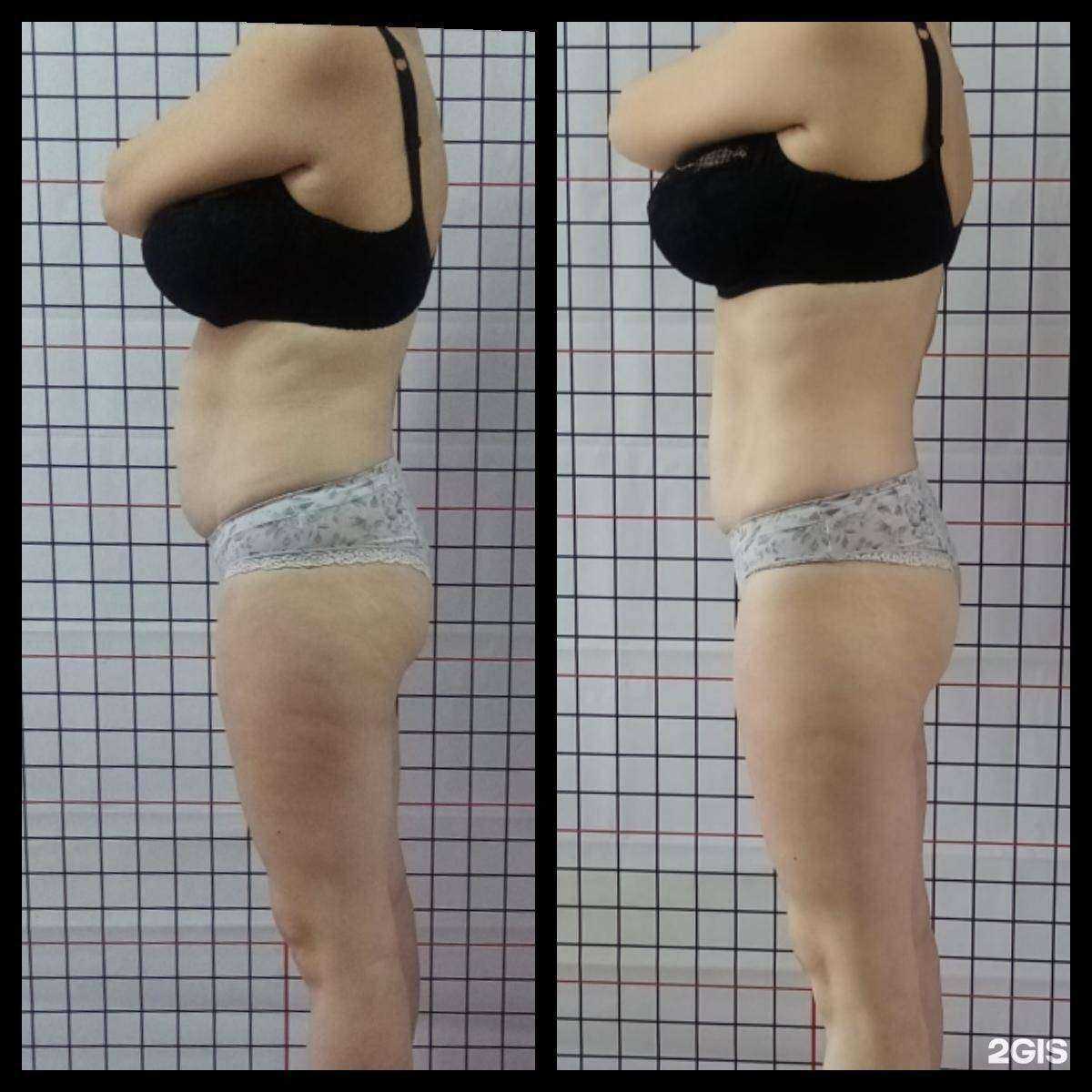 Отзывы на компанию Mira_studkras в г. Кемерово c фото