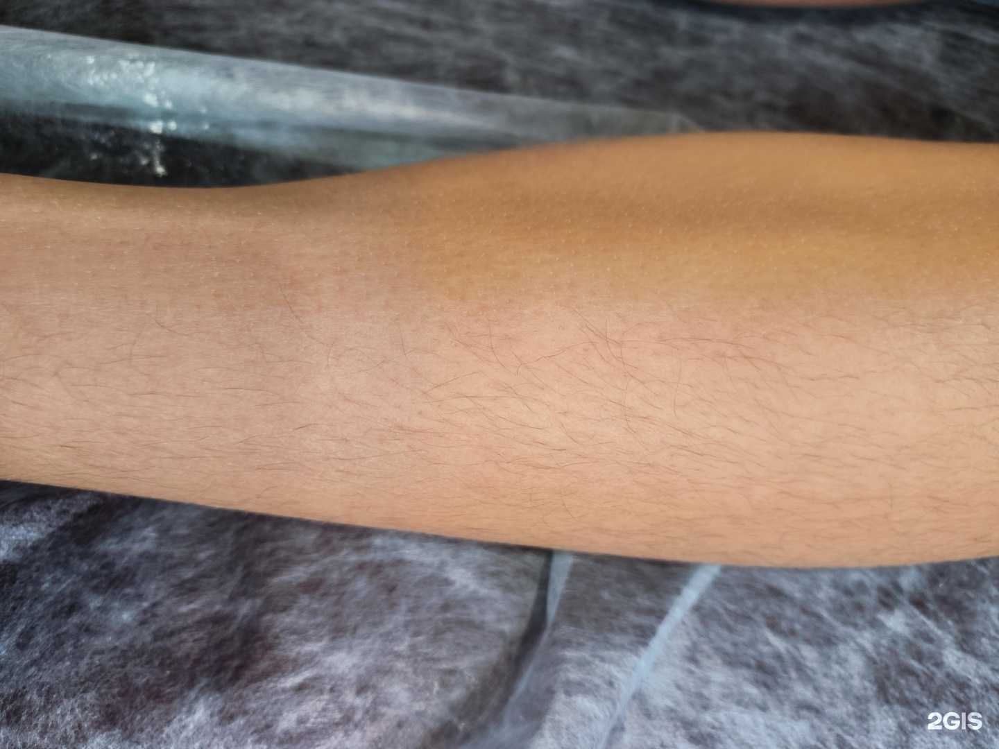 Отзывы на компанию Epil_gum в г. Уфа c фото