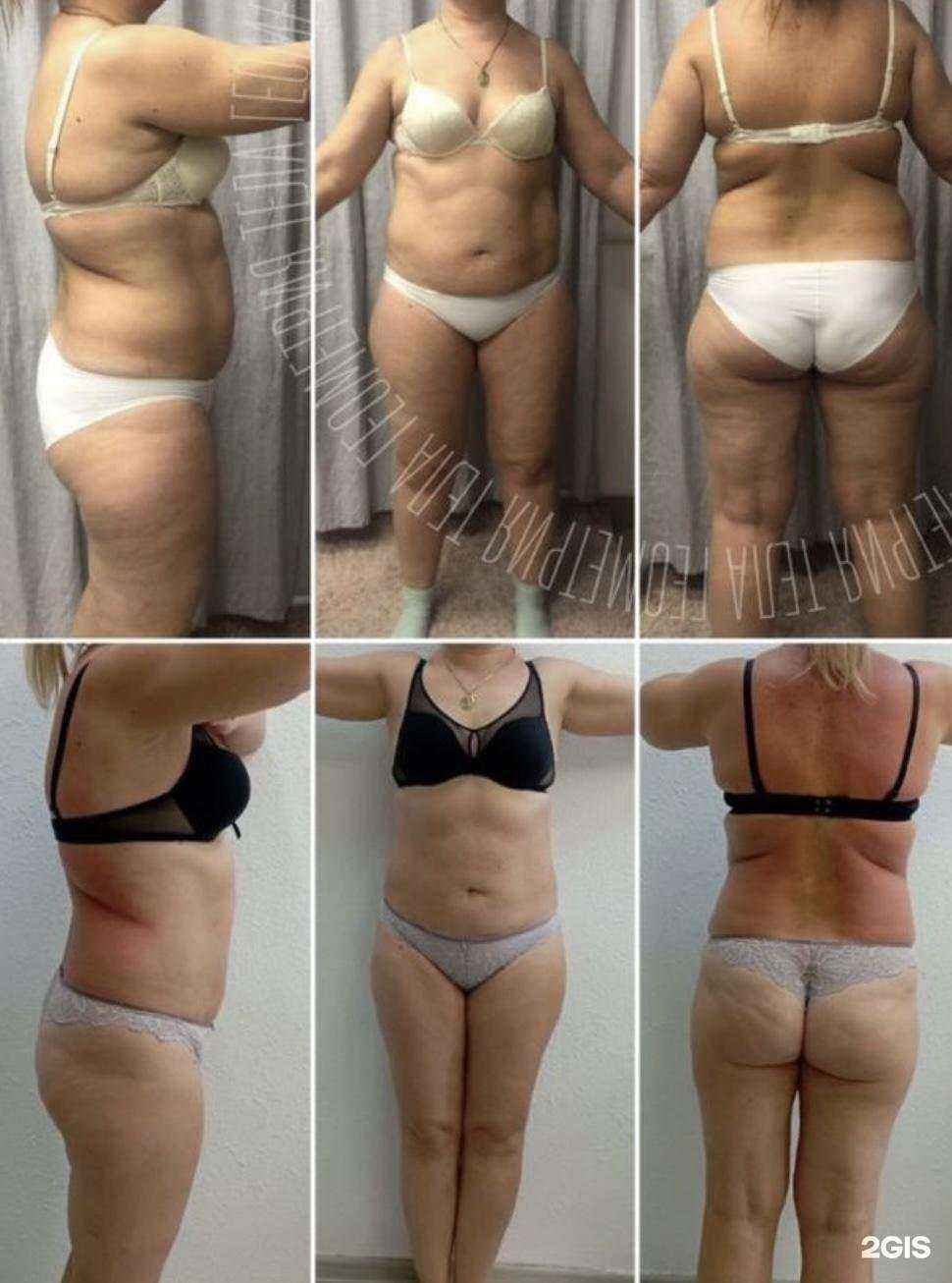 Отзывы на компанию Геометрия тела в г. Пермь c фото