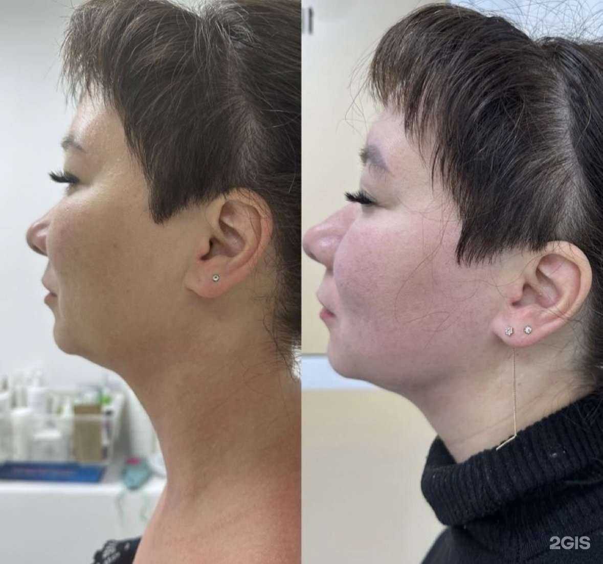 Отзывы на компанию Кабинет косметолога в Йошкар-Оле c фото