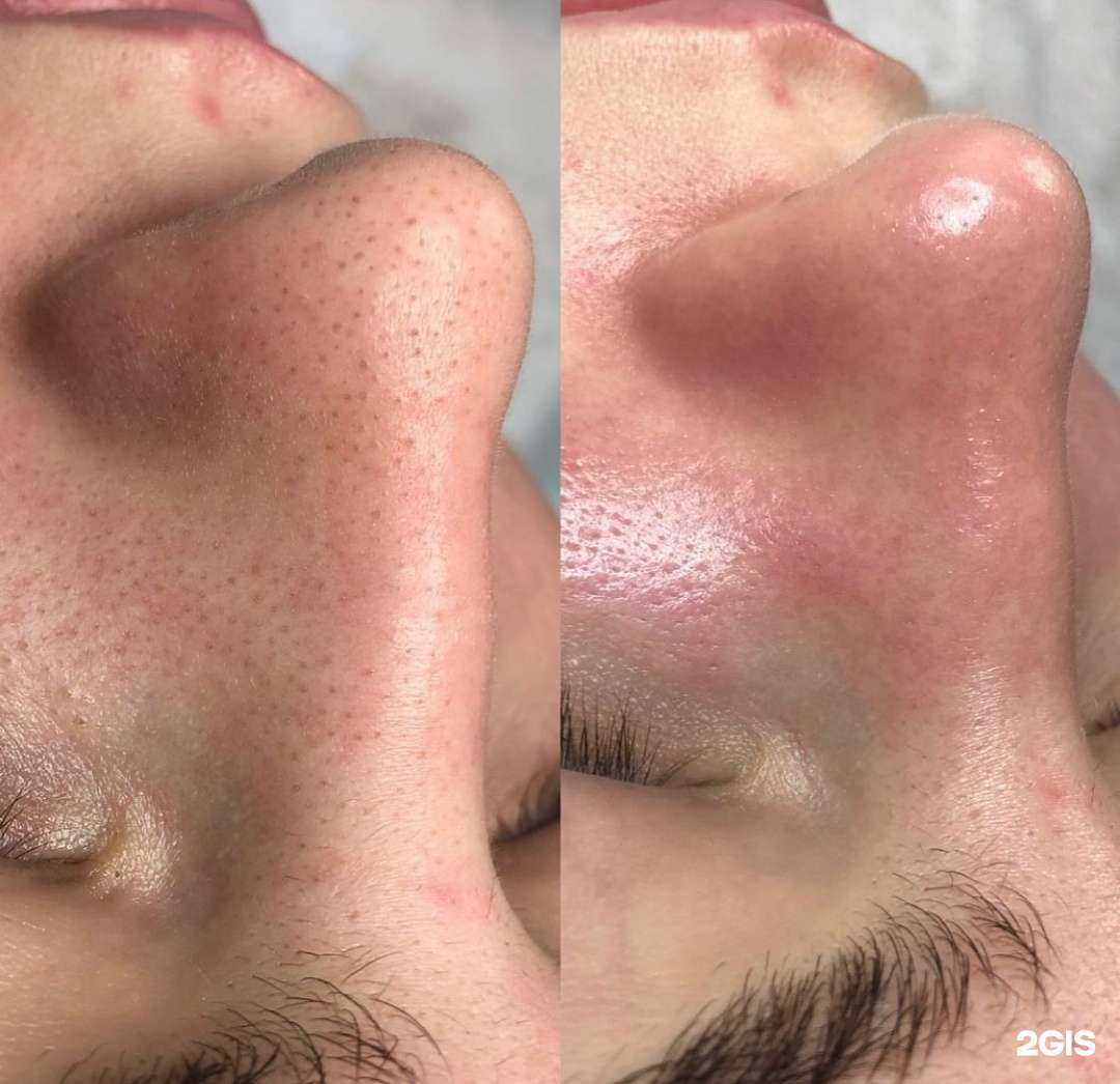 Отзывы на компанию I`m aesthetic  в Сочи c фото