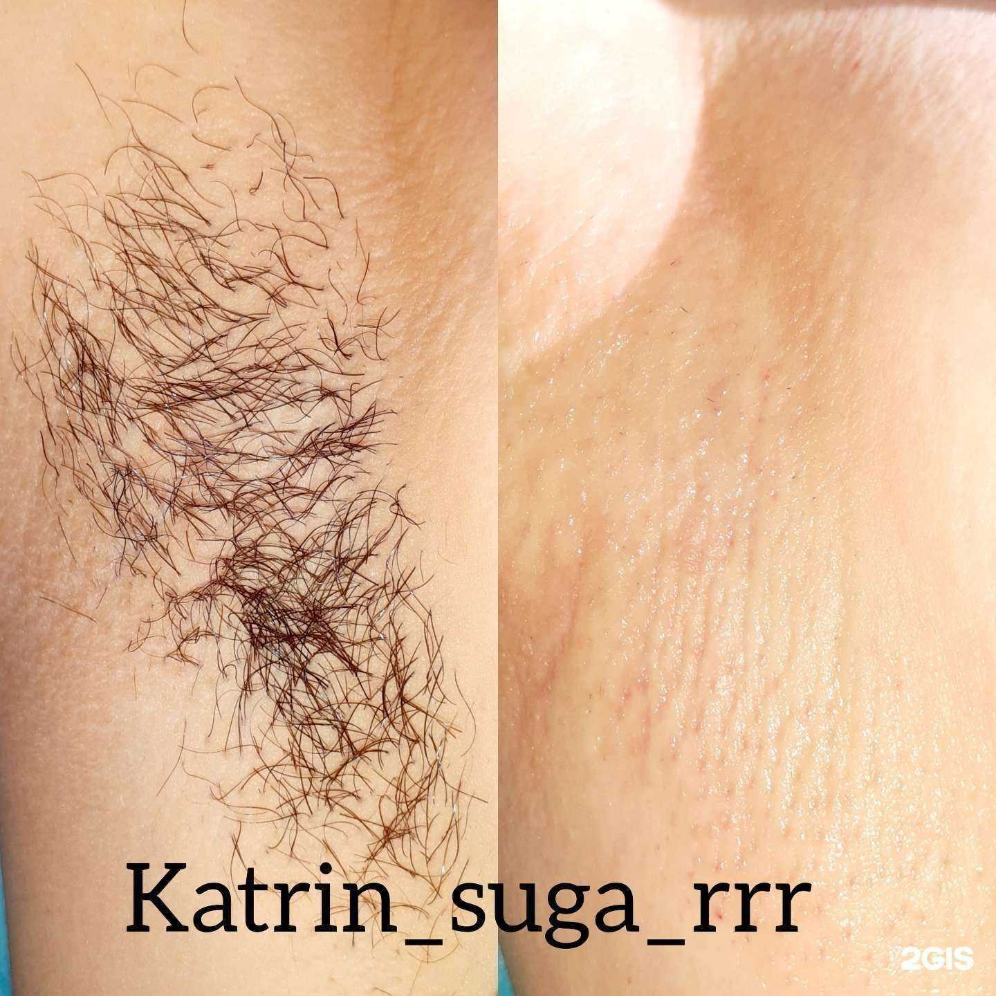 Отзывы на компанию Beauty_AkuLove в г. Томск c фото