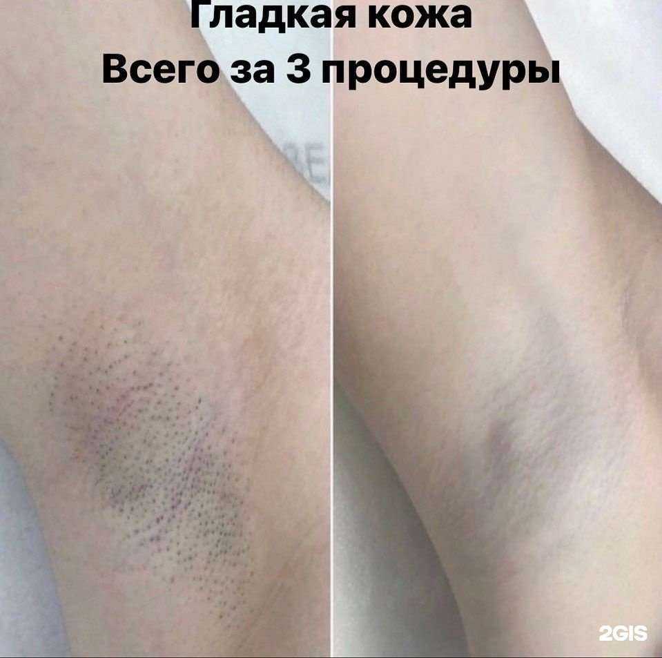 Отзывы на компанию Кабинет эпиляции и коррекции фигуры в Нижнекамске c фото