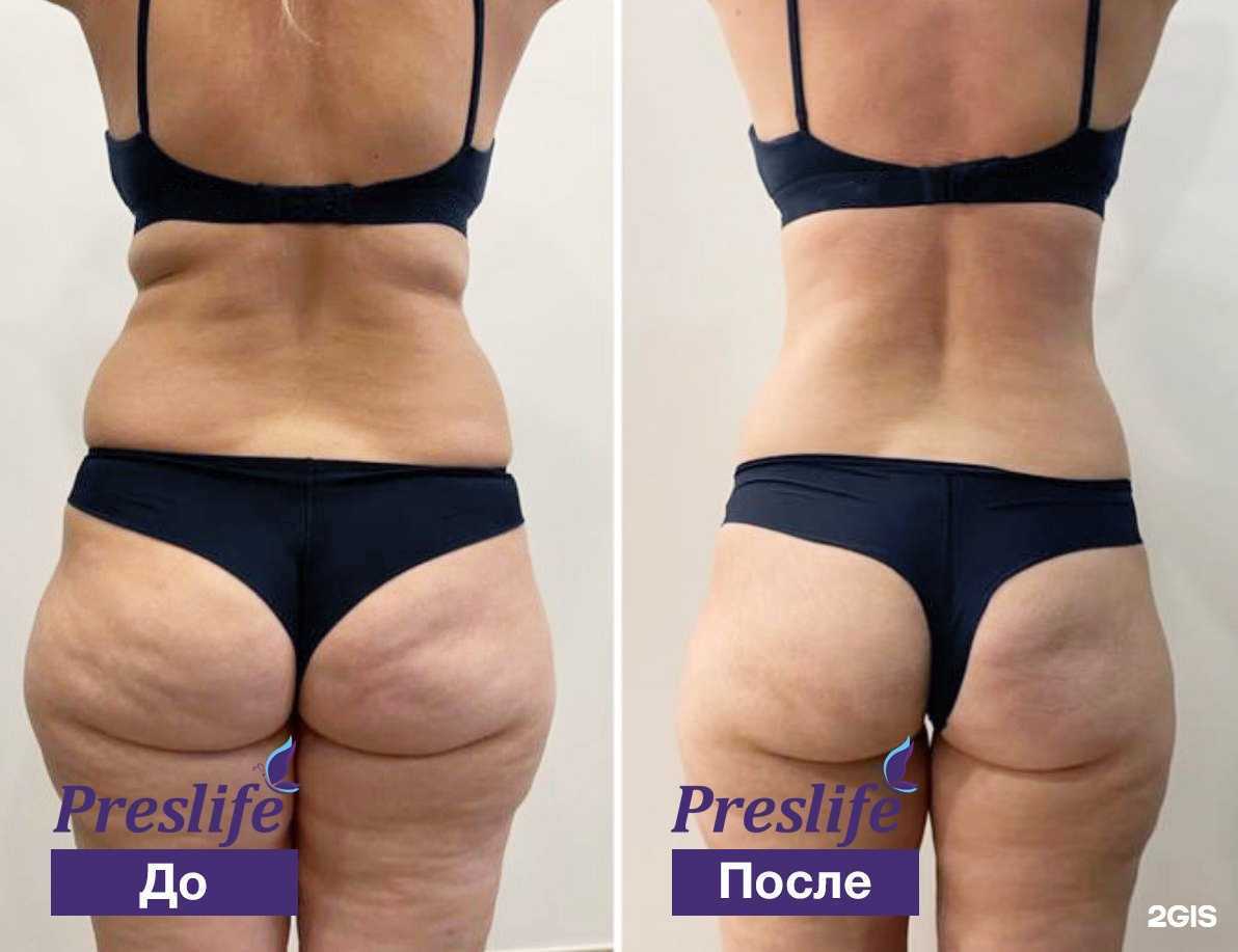 Отзывы на компанию Preslife в Сарове c фото