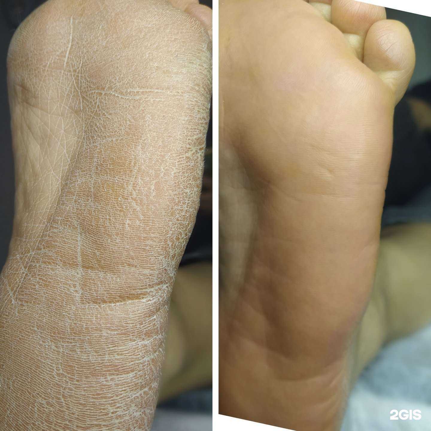 Отзывы на компанию Студия маникюра и педикюра Вероники Гончар в Сургуте c фото