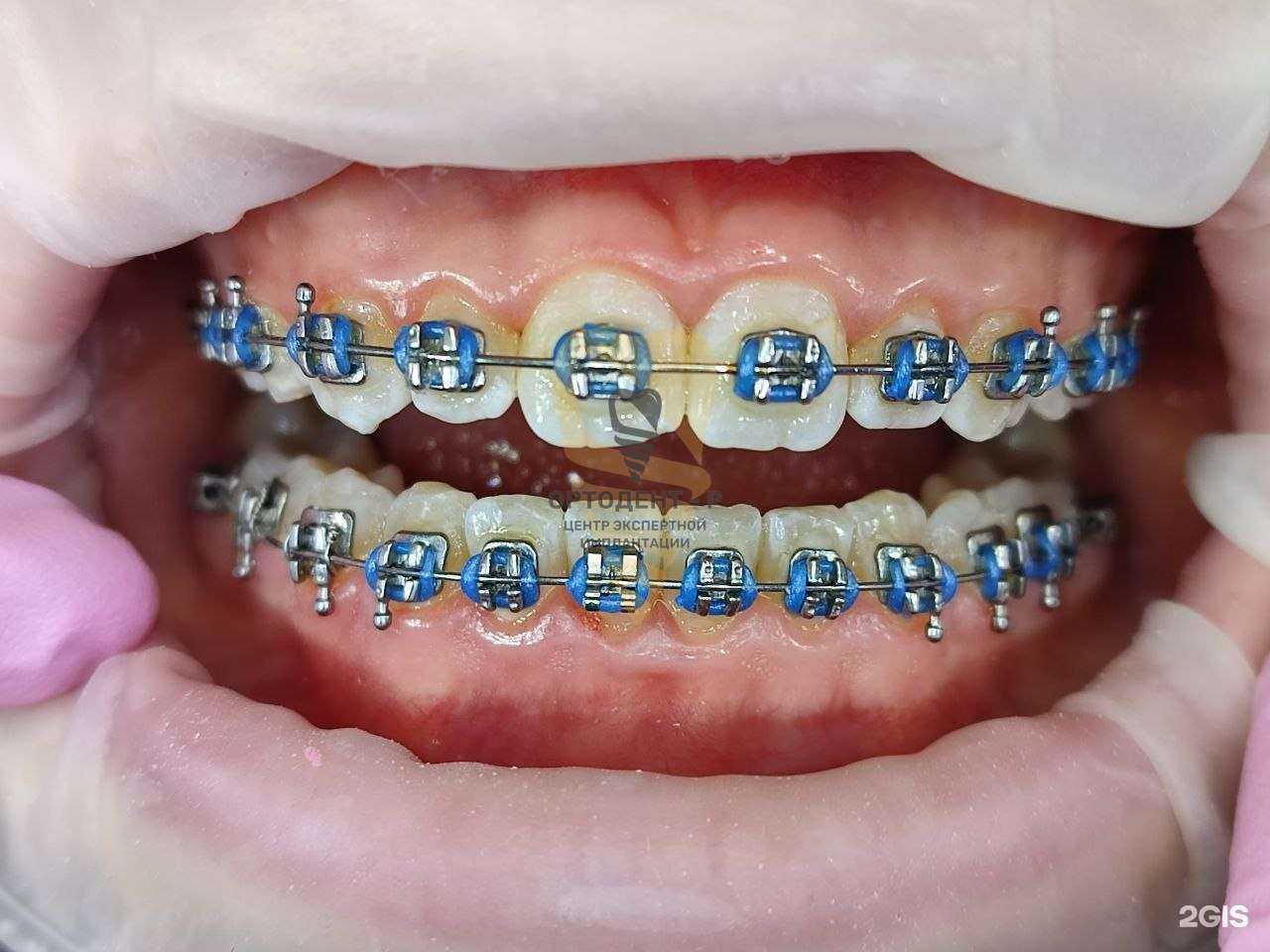 Отзывы на компанию Ортодент-Р в Владивостоке c фото
