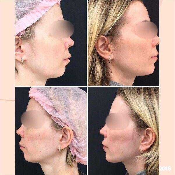 Отзывы на компанию Линлайн в Новороссийске c фото