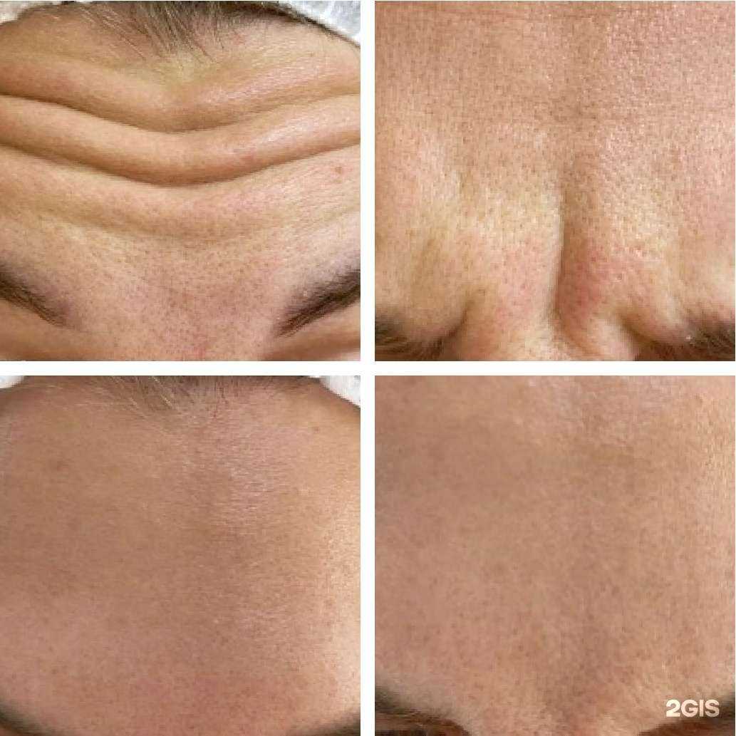 Отзывы на компанию Кабинет косметолога в Иркутске c фото