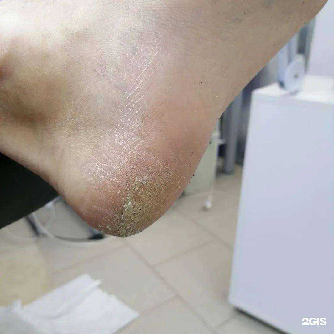 Отзывы на компанию Студия Smart педикюра и моментального загара Н. О. в г. Великий Новгород c фото