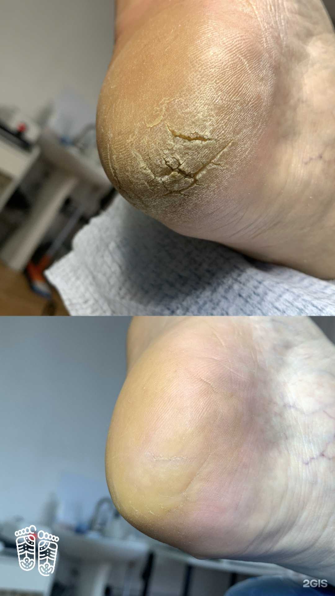 Отзывы на компанию  Proffeet  в Сыктывкаре c фото