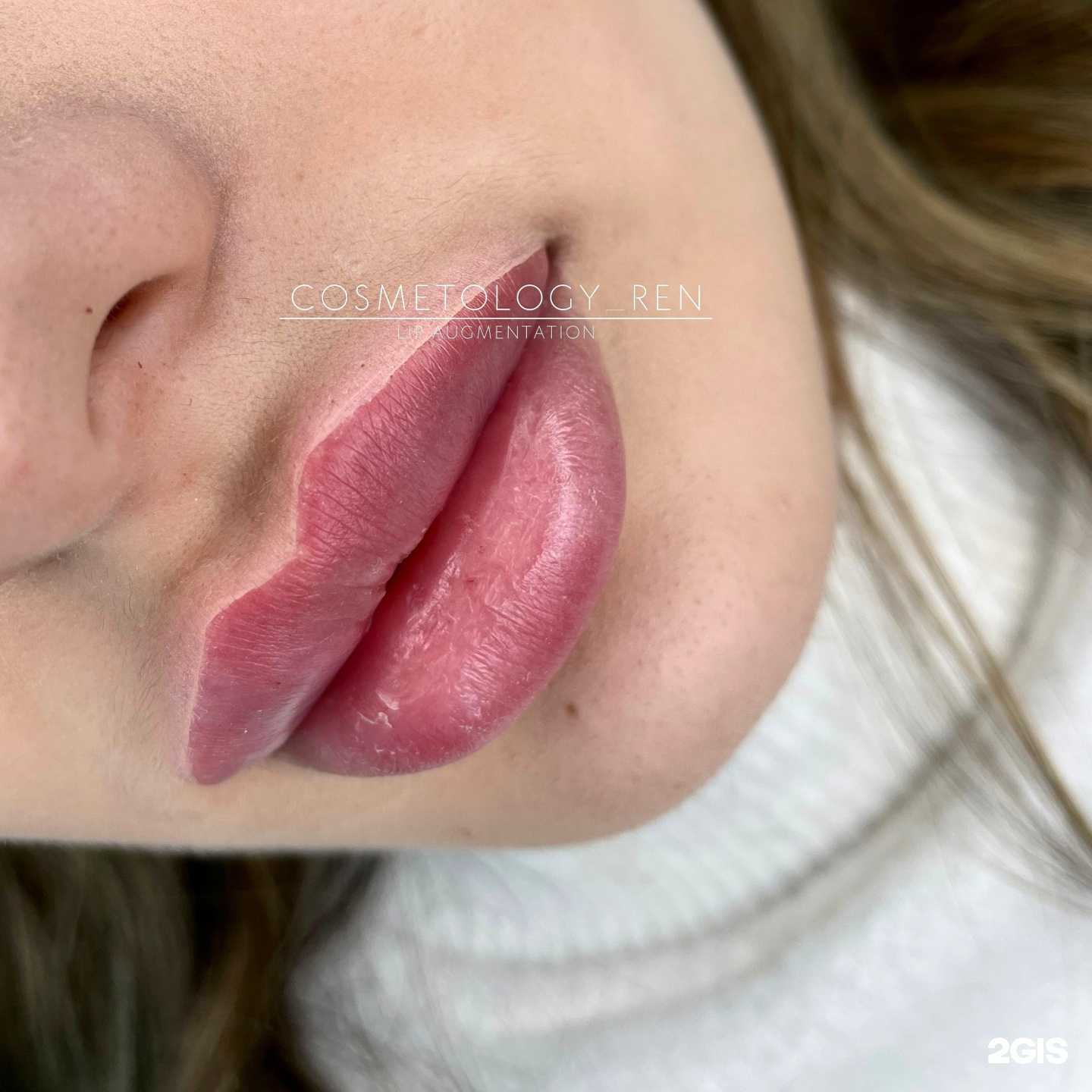 Отзывы на компанию Cosmetology_ren в Уфе c фото