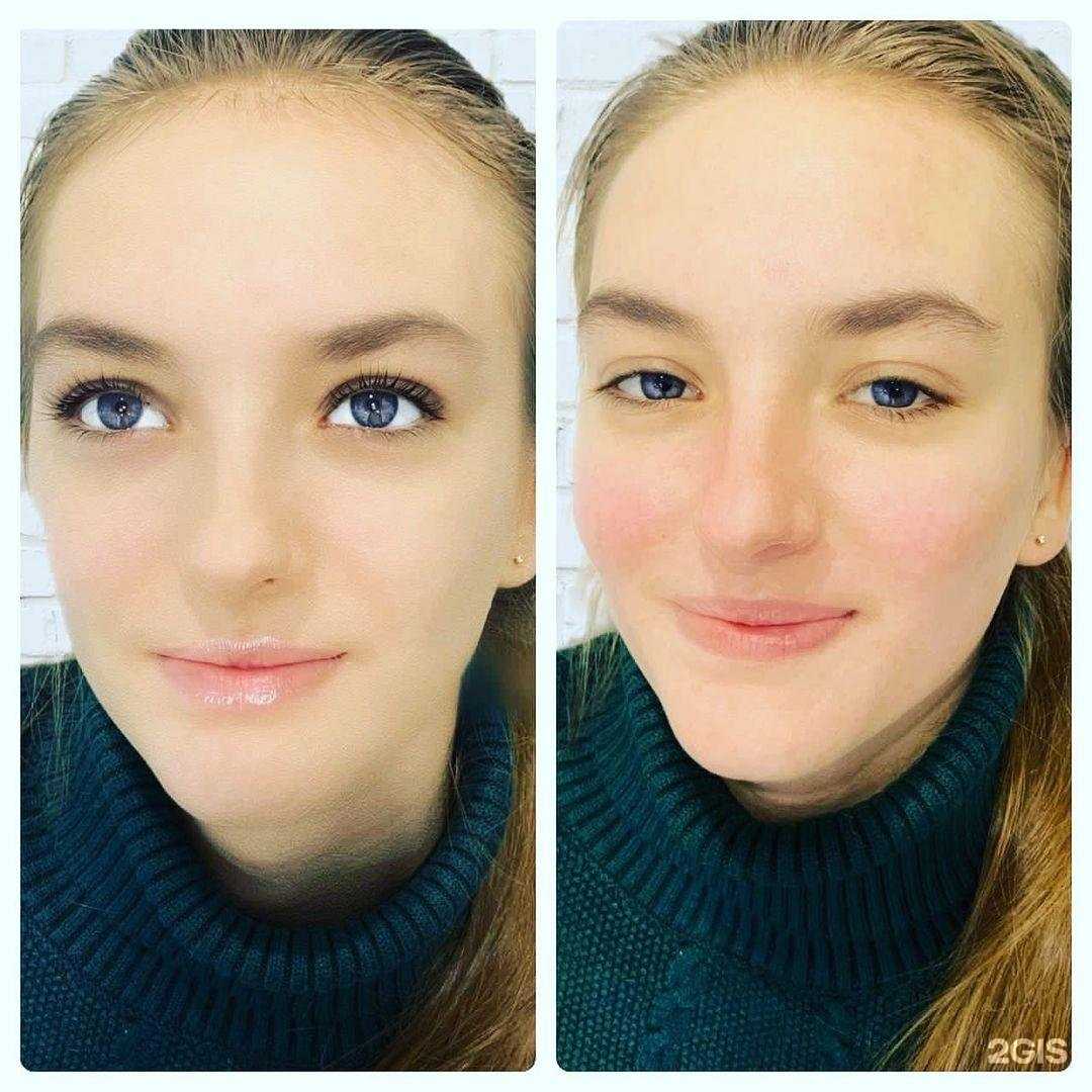 Отзывы на компанию Estet в г. Новосибирск c фото