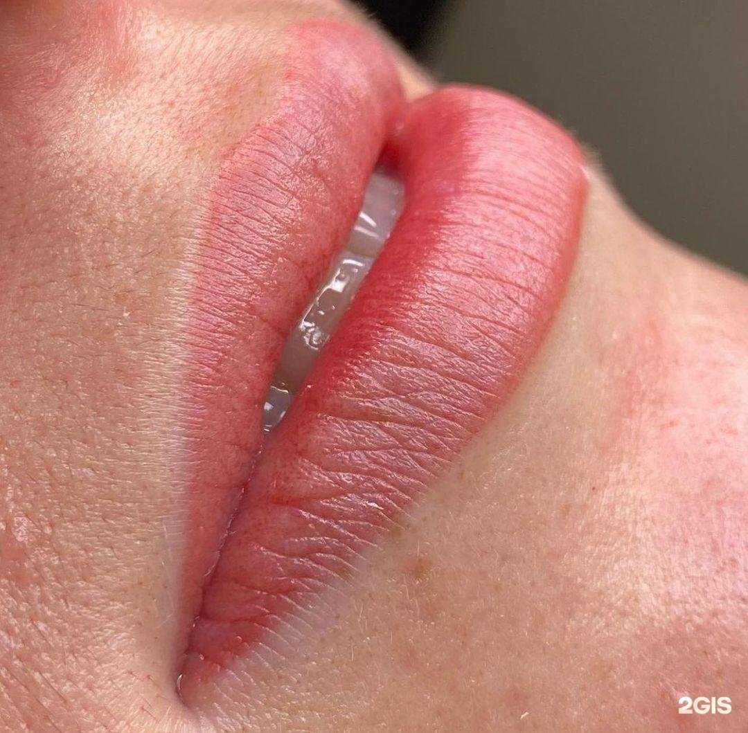 Отзывы на компанию Luxe Clinic в г. Тарко-Сале c фото