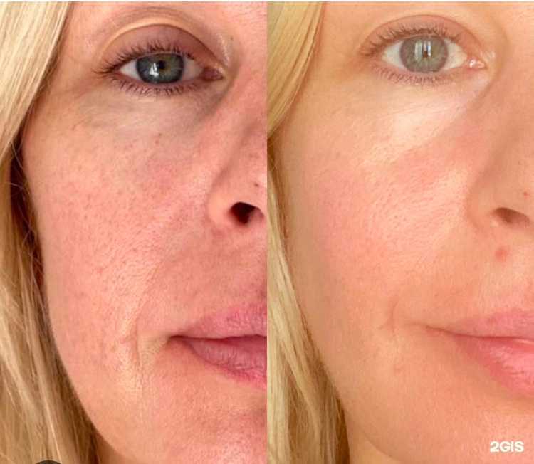 Отзывы на компанию Кабинет эпиляции и косметологии в Сочи c фото