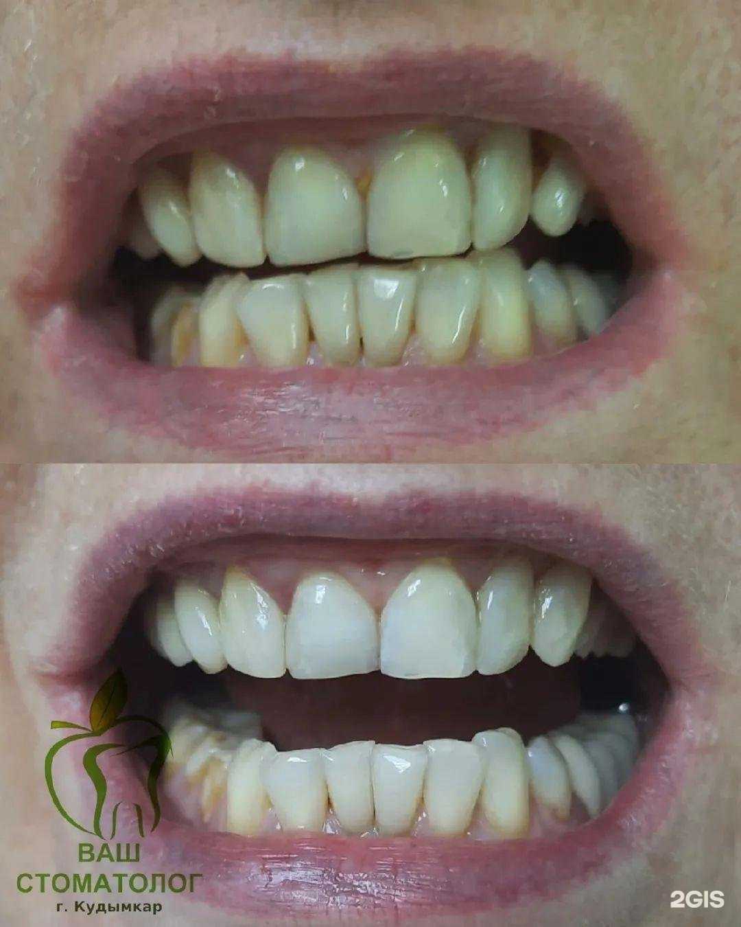 Отзывы на компанию Ваш стоматолог в г. Кудымкар c фото