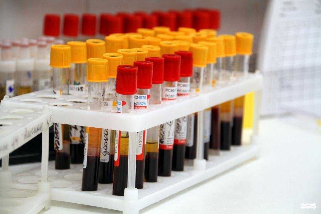 Отзывы на компанию Витэра в Липецке c фото