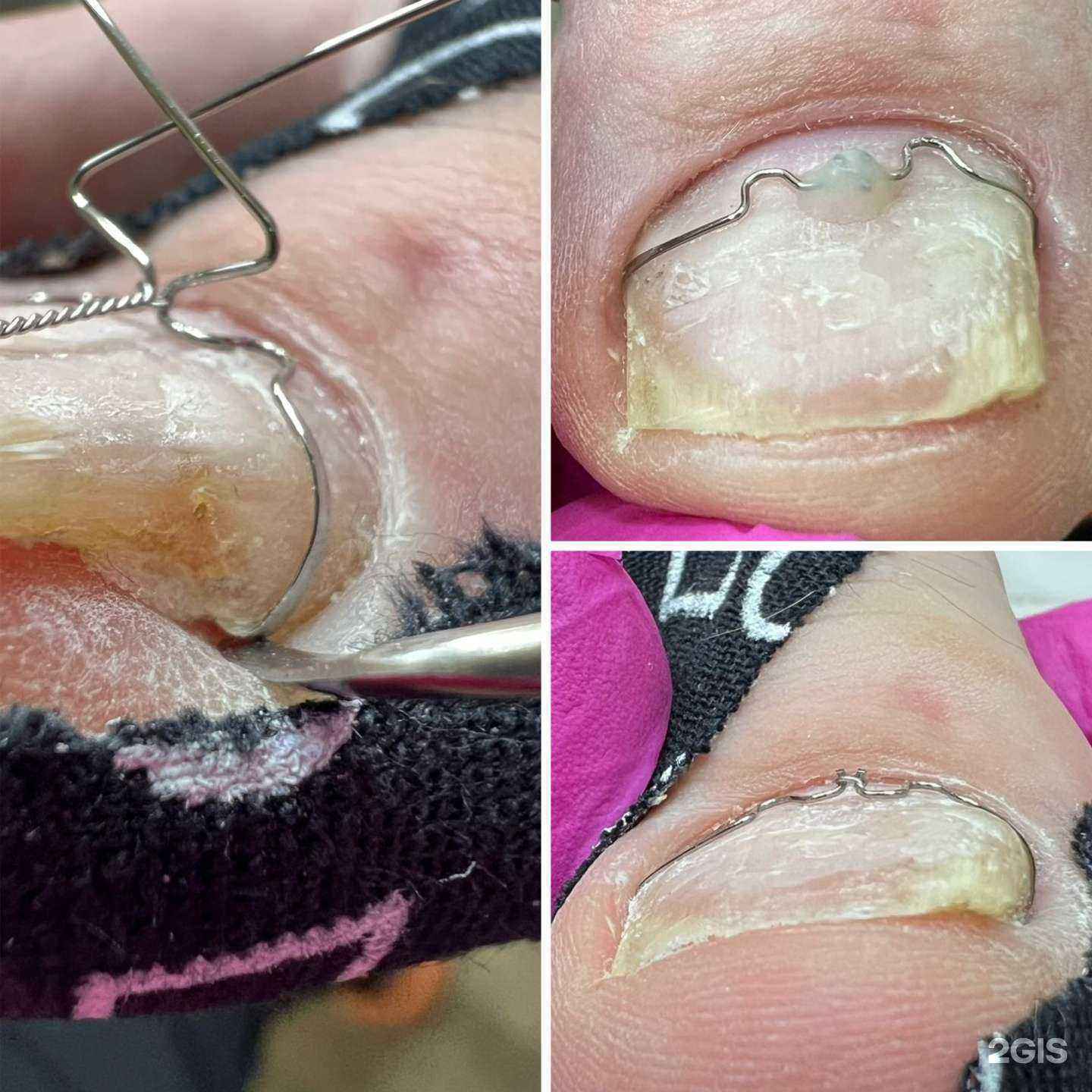 Отзывы на компанию Студия подологии в Новосибирске c фото