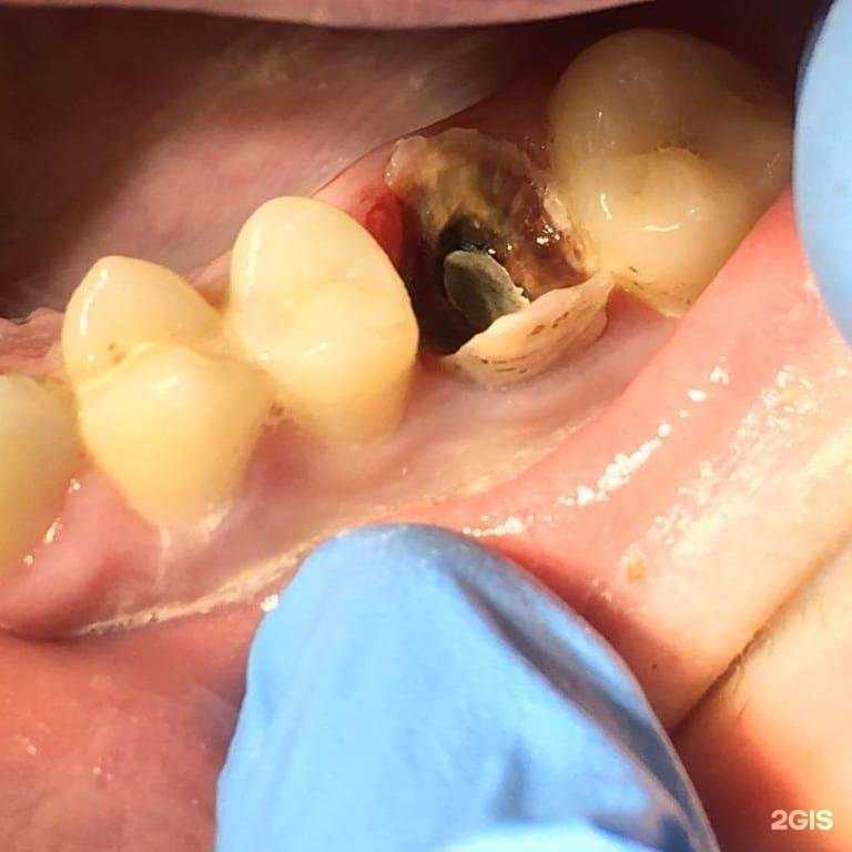 Отзывы на компанию Стоматология в г. Дербент c фото