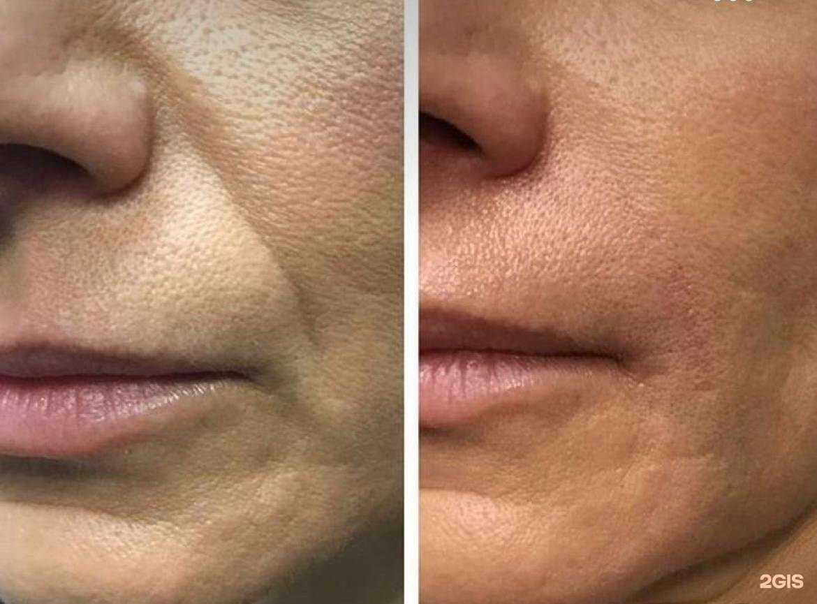 Отзывы на компанию Beuty Haus в Новосибирске c фото