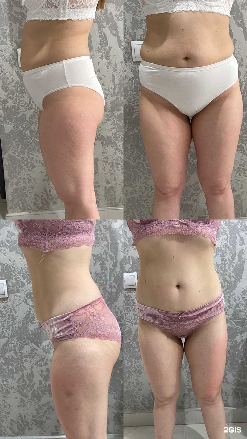 Отзывы на компанию Easy Body в Бийске c фото