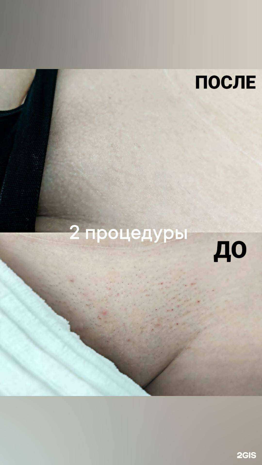 Отзывы на компанию Студия эпиляции в г. Иркутск c фото