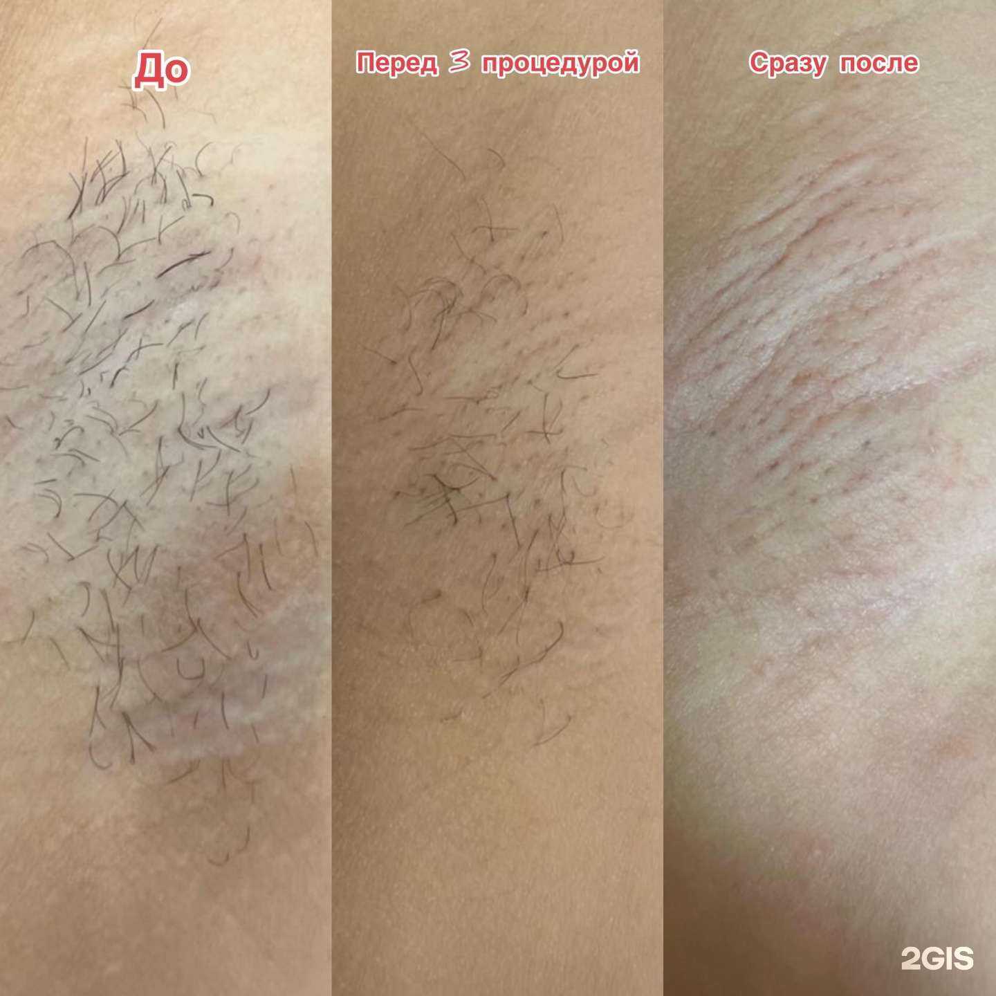 Отзывы на компанию Кабинет эпиляции в Челябинске c фото