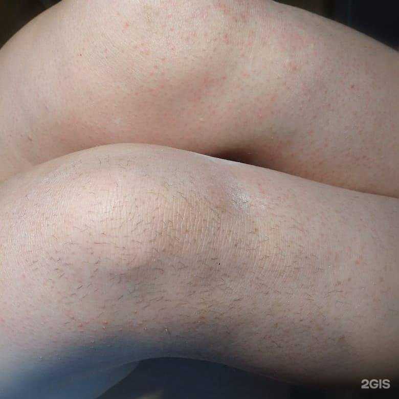 Отзывы на компанию Шугарзона в Хабаровске c фото