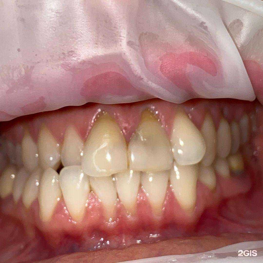 Отзывы на компанию Апекс в Ростове-на-Дону c фото