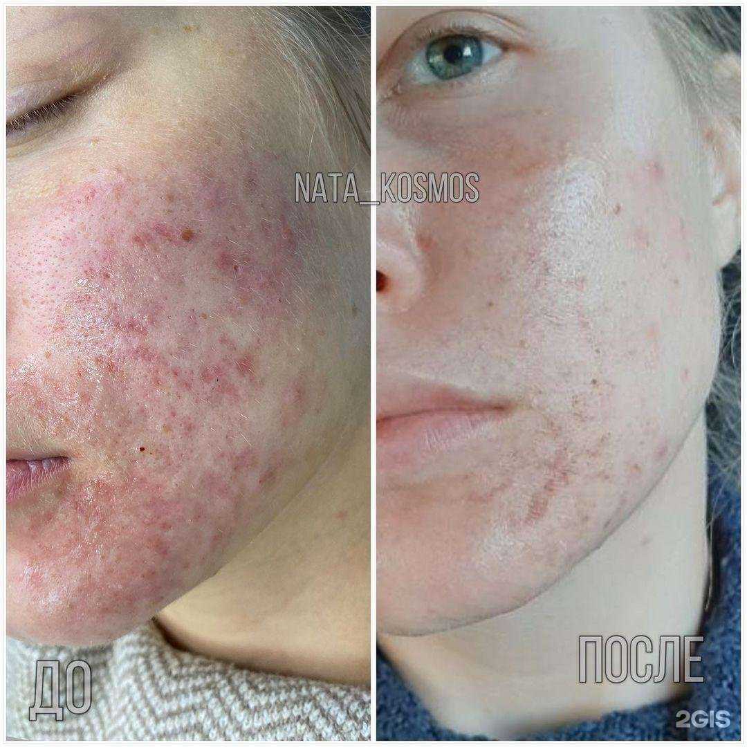 Отзывы на компанию Студия косметологии и эпиляции Натальи Арефьевой в Нижнем Новгороде c фото