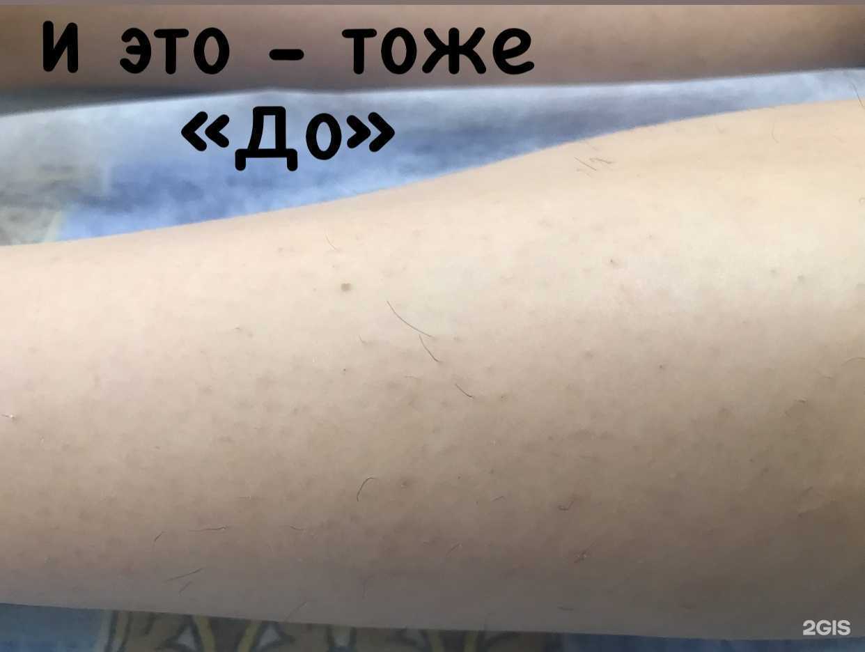 Отзывы на компанию Кабинет эпиляции в Краснодаре c фото