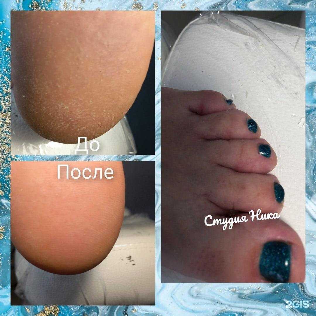 Отзывы на компанию Ника в г. Кирово-Чепецк c фото