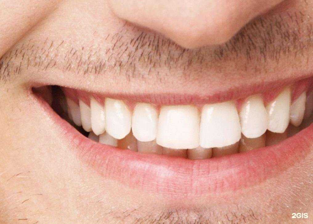 Отзывы на компанию Ideal Dent в Сочи c фото