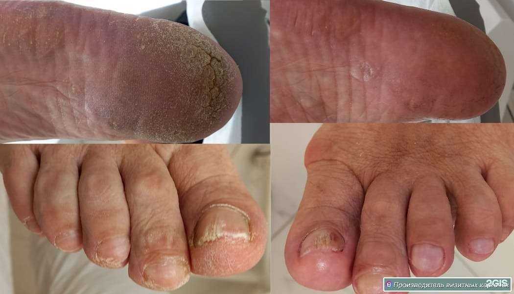 Отзывы на компанию Scharm ногтей в Калининграде c фото