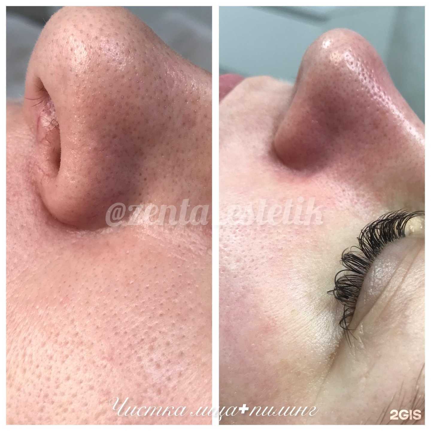 Отзывы на компанию Кабинет косметолога в Новосибирске c фото