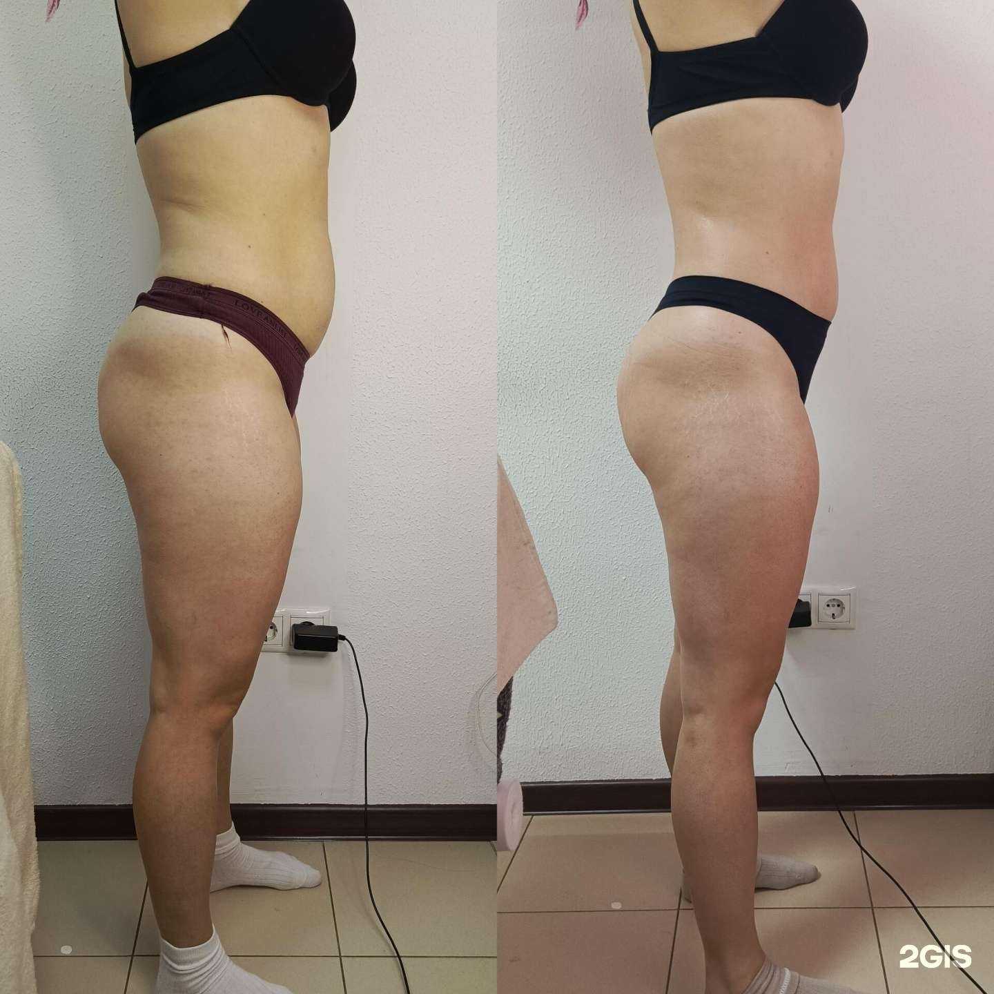 Отзывы на компанию Body_mechtii в г. Краснодар c фото