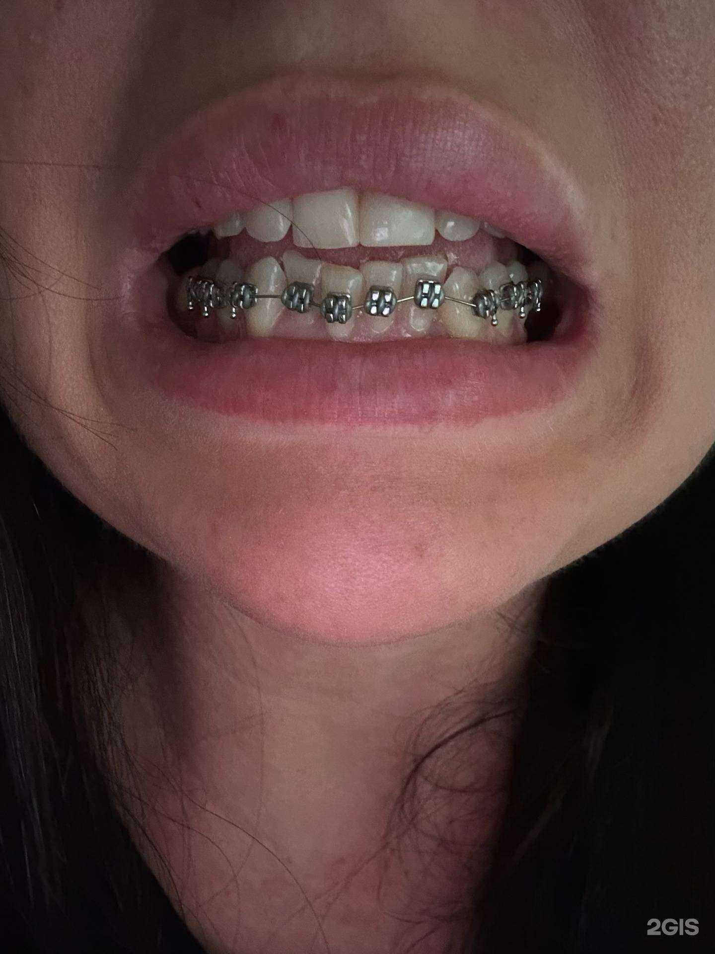 Отзывы на компанию Дентис в Артёме c фото