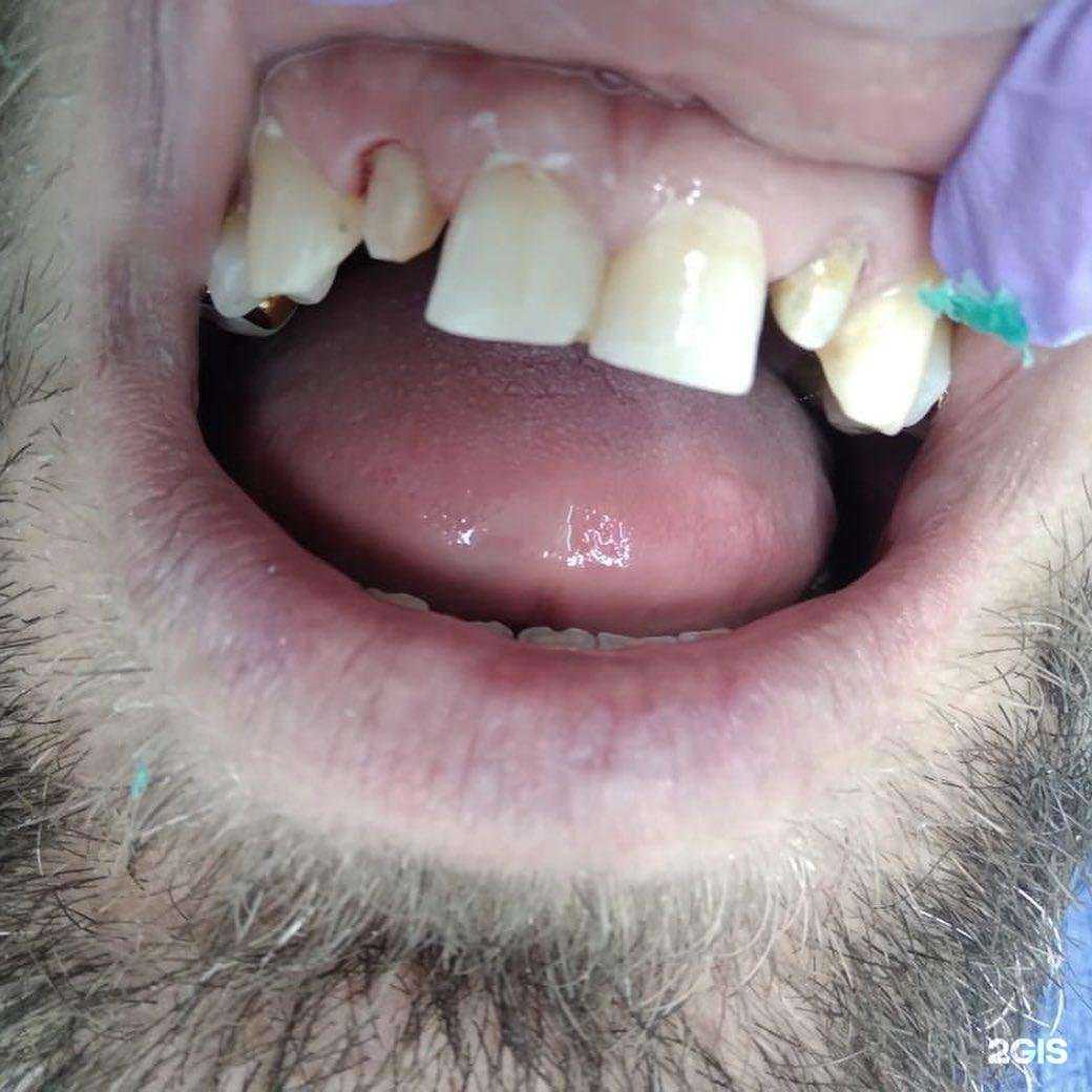 Отзывы на компанию Стома-Дент в Хасавюрте c фото