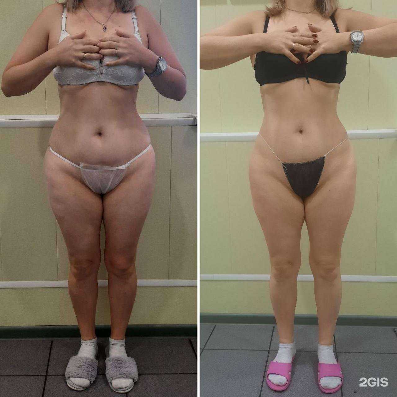 Отзывы на компанию Estetico в г. Тамбов c фото