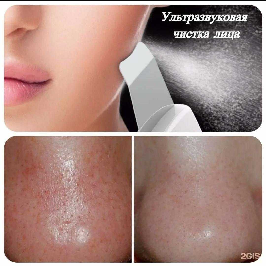 Отзывы на компанию MassageProfi в Краснодаре c фото