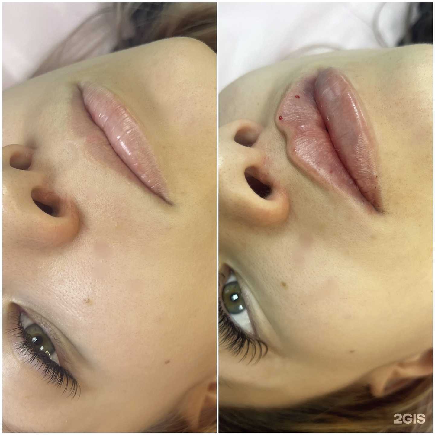 Отзывы на компанию Кабинет косметолога Елизаветы в Хабаровске c фото