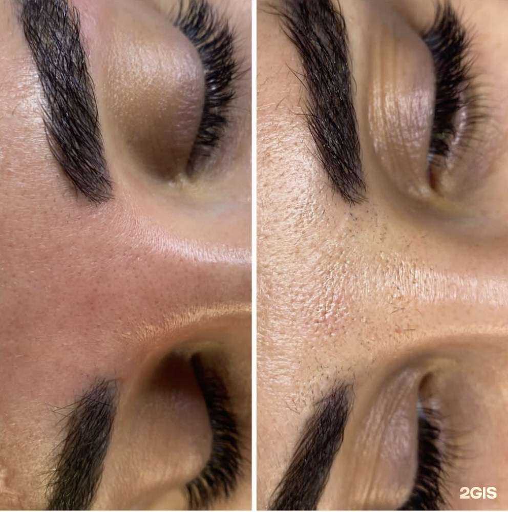 Отзывы на компанию Студия эпиляции, эстетики и массажа  в Перми c фото