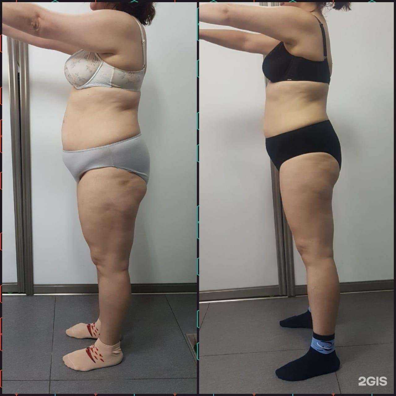 Отзывы на компанию Body dream в г. Уссурийск c фото