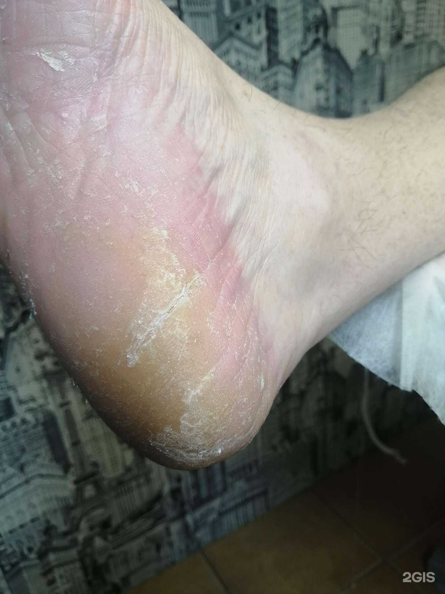 Отзывы на компанию PodoSfera в г. Череповец c фото