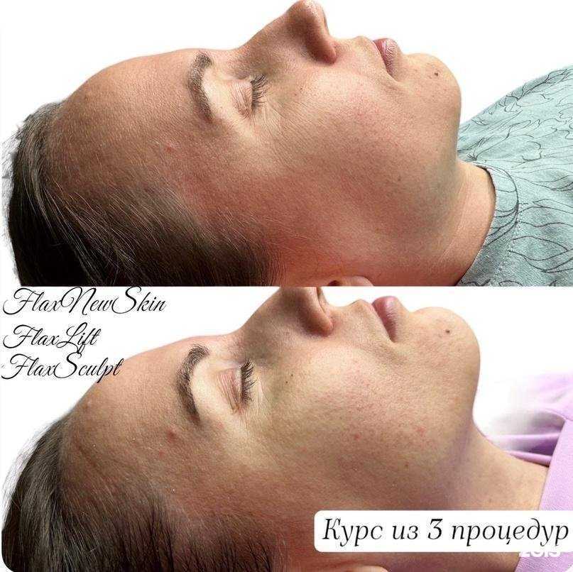 Отзывы на компанию FlaxTap в г. Красноярск c фото