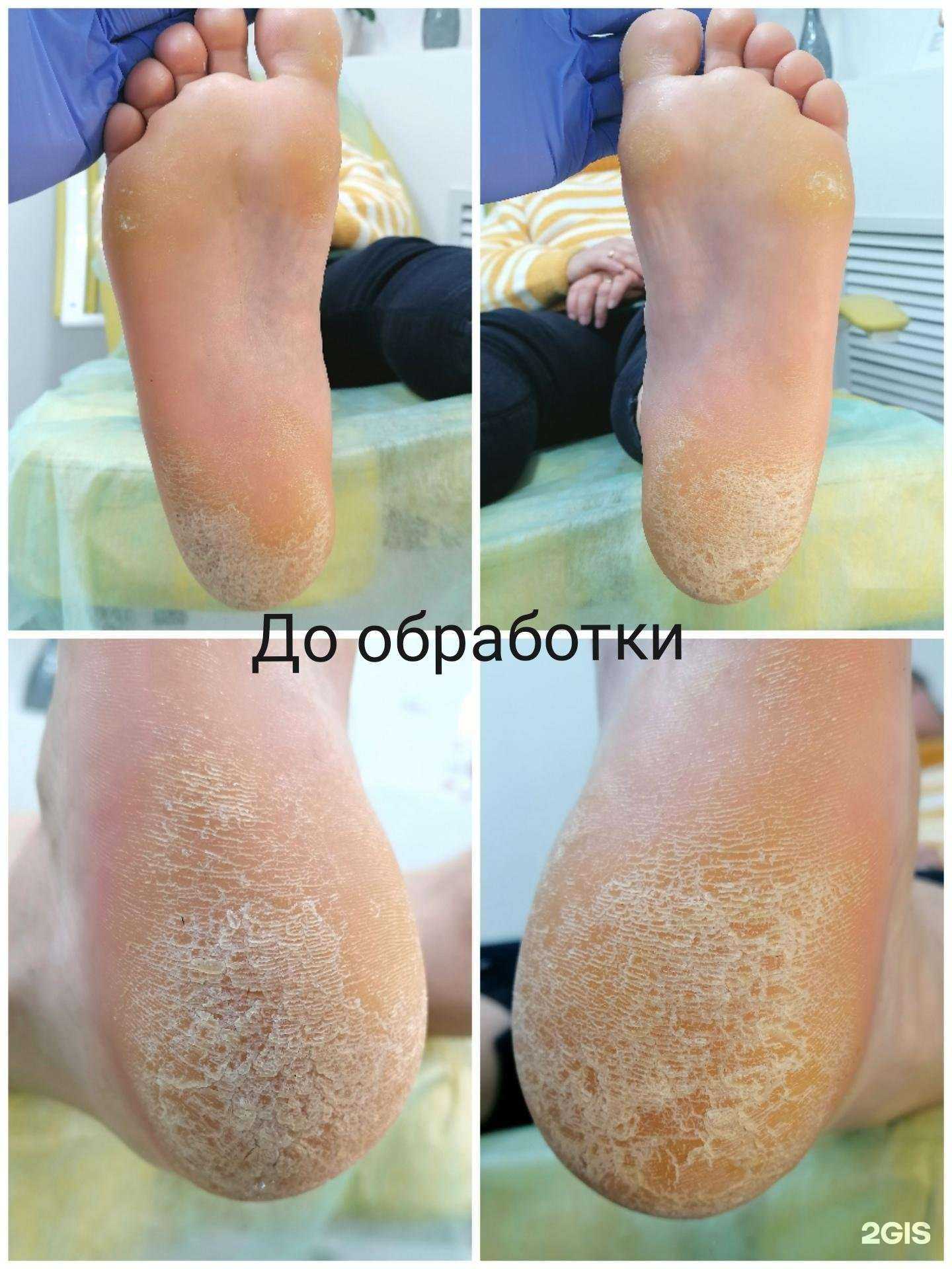 Отзывы на компанию Кабинет подолога Ильченко Татьяны в Ростове-на-Дону c фото