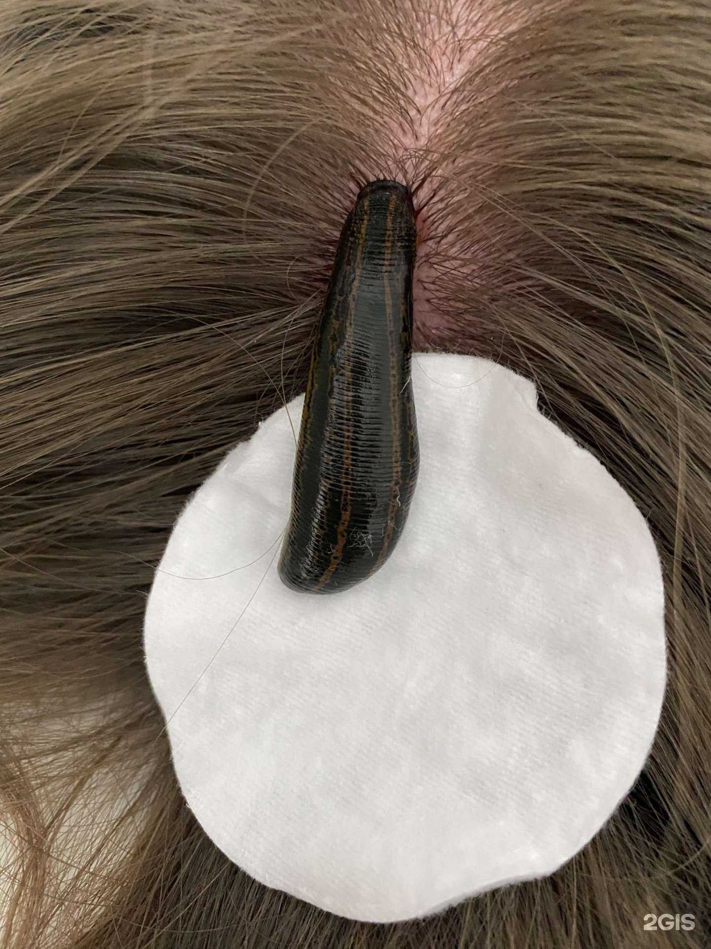 Отзывы на компанию Кабинет гирудотерапевта в г. Казань c фото