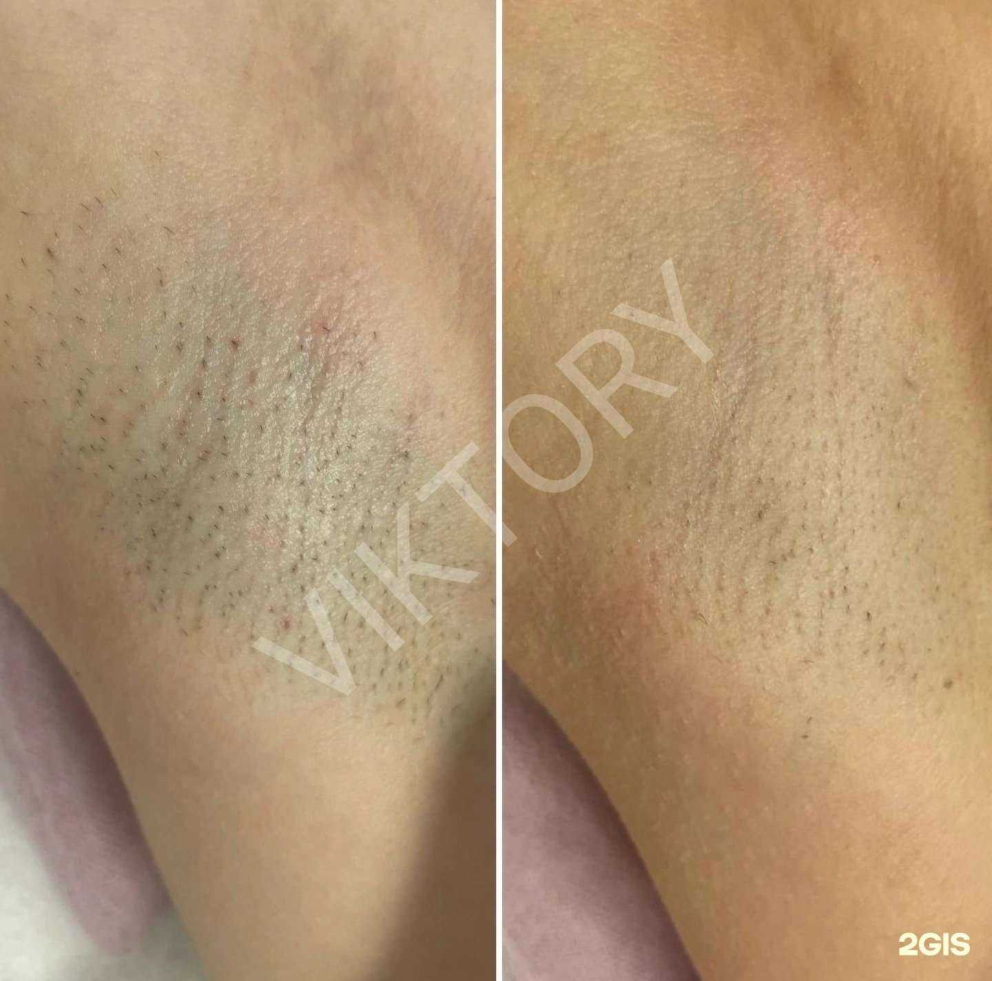 Отзывы на компанию Viktory в Самаре c фото